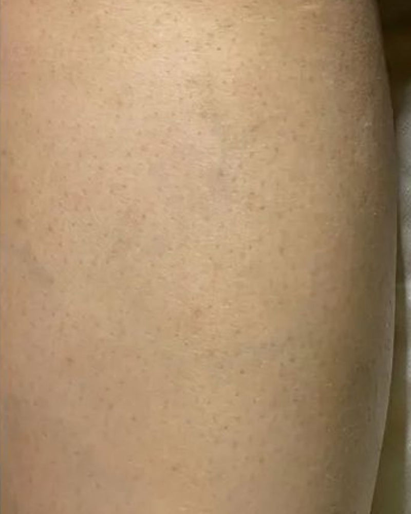 Después